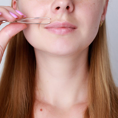 Hirsutism Treatment in Vijayawada